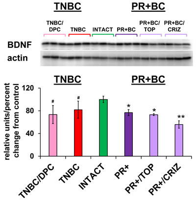 Levels of BDNF in the PFC tissues of intact and TNBC and PR+BC-bearing chemotherapy treated and untreated TumorGraft mice.