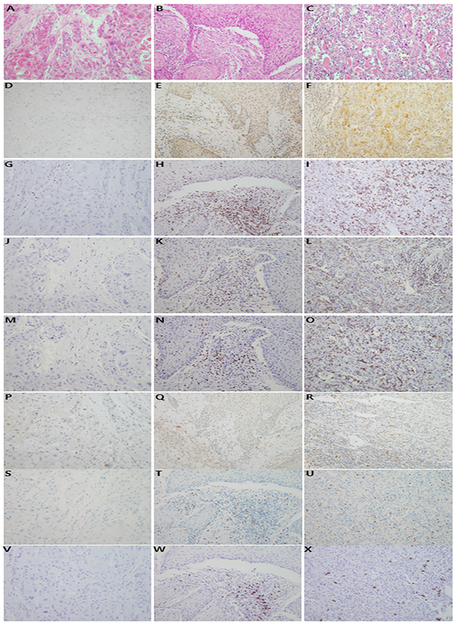 Representative features of histologic and immunohistochemical analyses.