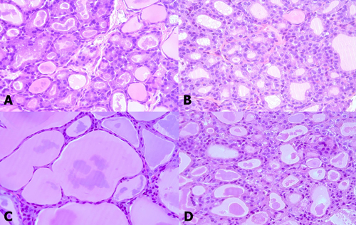 Thyroid follicle morphology of young (A, B) and old (C, D) rats exposed to room (A, C) and cold (B, D) temperatures.