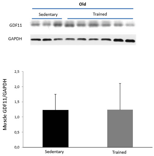 GDF11 protein expression in skeletal muscles of sedentary vs trained old mice.