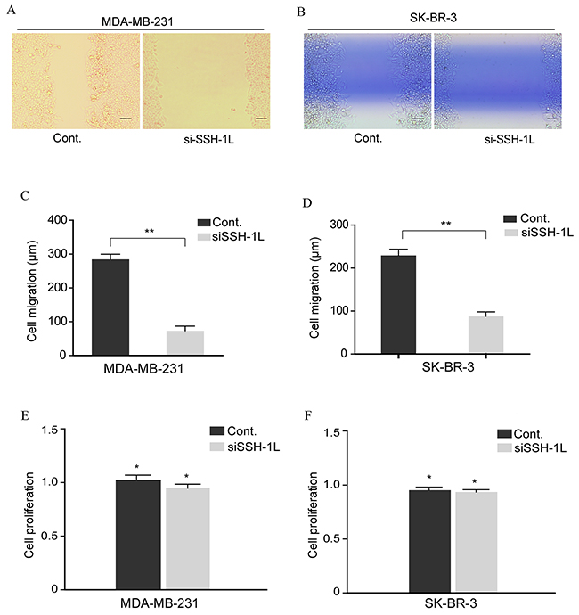 Inhibition of SSH-1L expression reduces breast cancer cell migration.