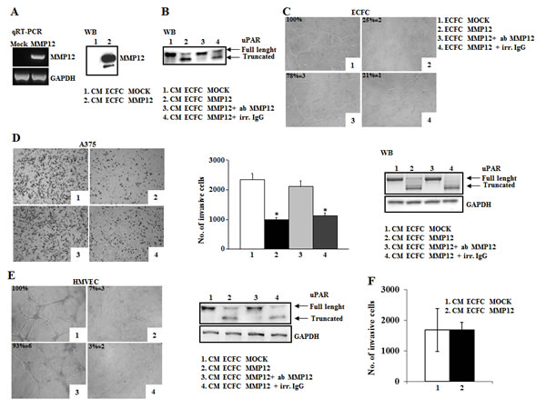 The anti-tumoral efficacy of MMP12-engineered ECFC in vitro and in vivo.