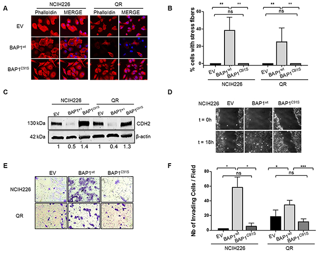 BAP1 deubiquitinase activity is associated with morphological changes and acquired invasive/migratory capacities.