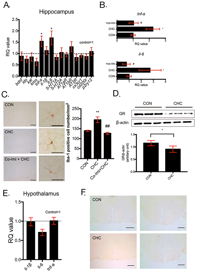 CHC increased inflammatory reaction in the hippocampus but not in the hypothalamus.