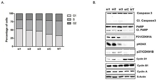 USP5 knockdown leads to DNA damage, impaired cell cycle progression and apoptosis.