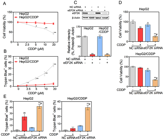 Silence eEF2K enhance CDDP-induced cytotoxicity in human HCC cells.