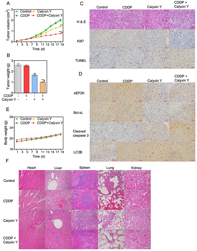 Calyxin Y and CDDP synergistically inhibit tumor growth in HepG2/CDDP xenograft tumor models in vivo.