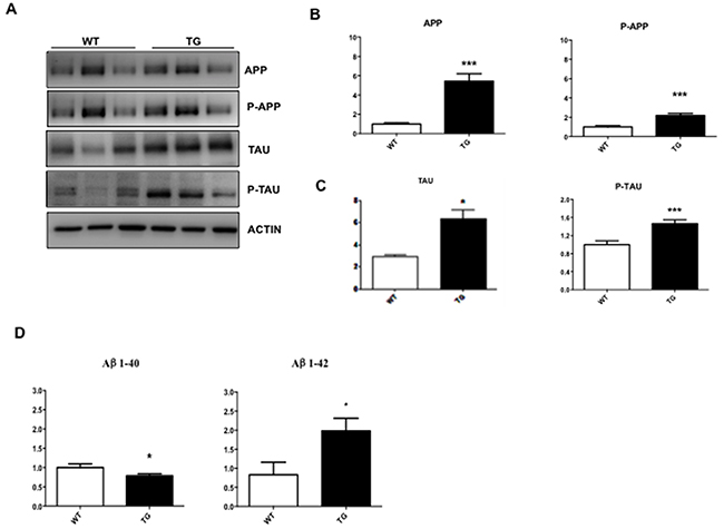 Characterization of whole eye extracts in TgCRND8 mice.