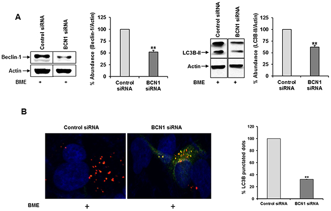 Knockdown of Beclin-1 suppresses BME induced autophagy in breast cancer cells.