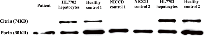 Western blotting analysis of mitochondrial proteins.