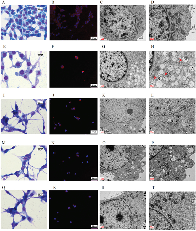 Morphology of CT26 colorectal adenocarcinoma cells after treatment with 10 mg/mL DBT-PD for 48 h.