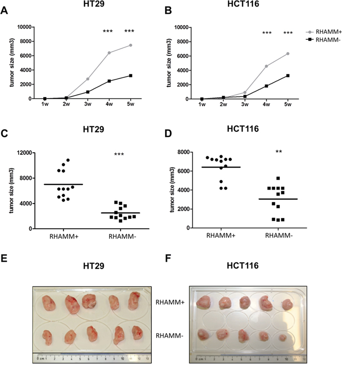 RHAMM silencing reduces the tumorigenicity of CRC cells in vivo.