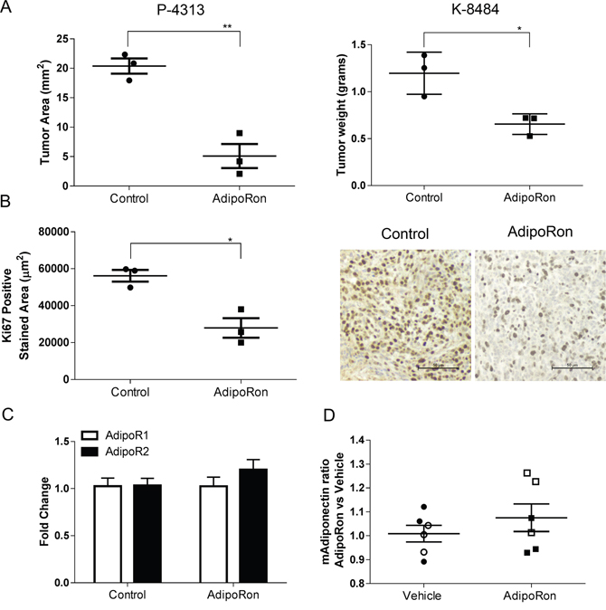 AdipoRon inhibits orthotopic pancreatic tumor growth and tumor proliferation in vivo.