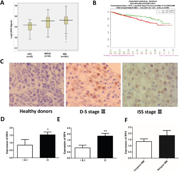 IRF4 is highly expressed in MM patients and associated with the MM clinical stages.