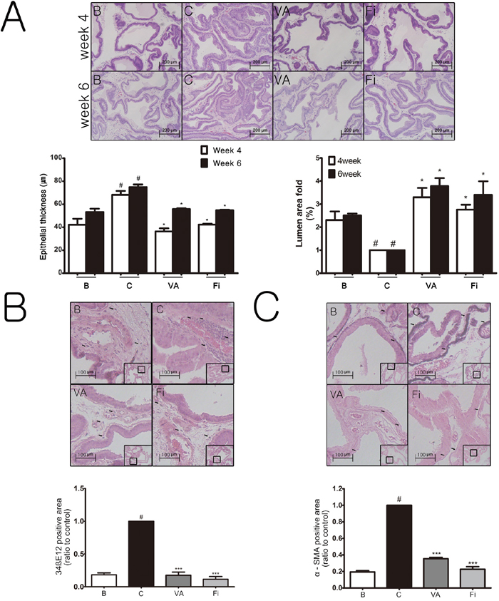 Effect of VA on histological changes of the prostate tissues in TP-induced BPH rats.