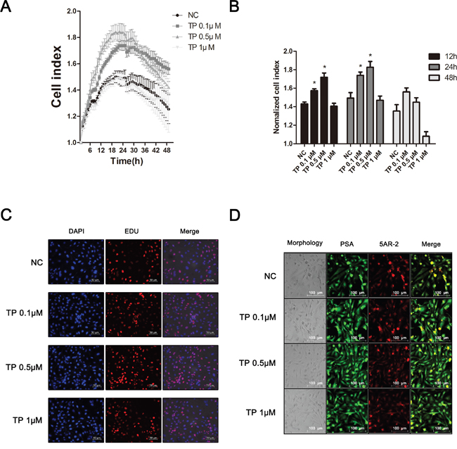 Effect of TP on proliferation and BPH-related factors in normal human prostatic epithelial RWPE-1 cells.