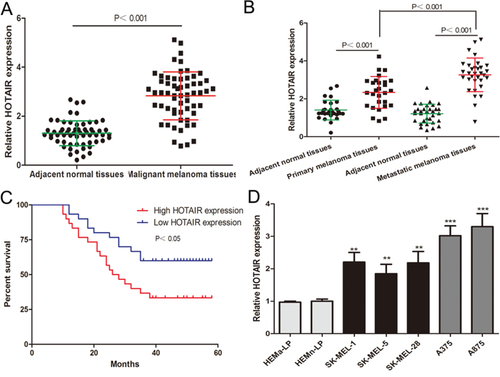 HOTAIR levels are elevated in melanoma and association with poor prognosis of melanoma patients.