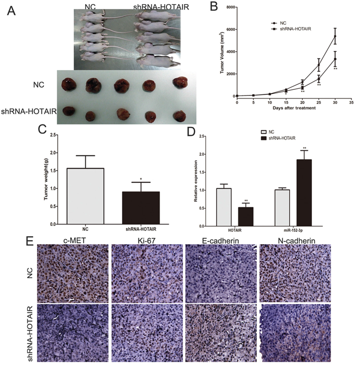 Inhibition of endogenous HOTAIR expression by shRNA inhibits melanoma growth in vivo.