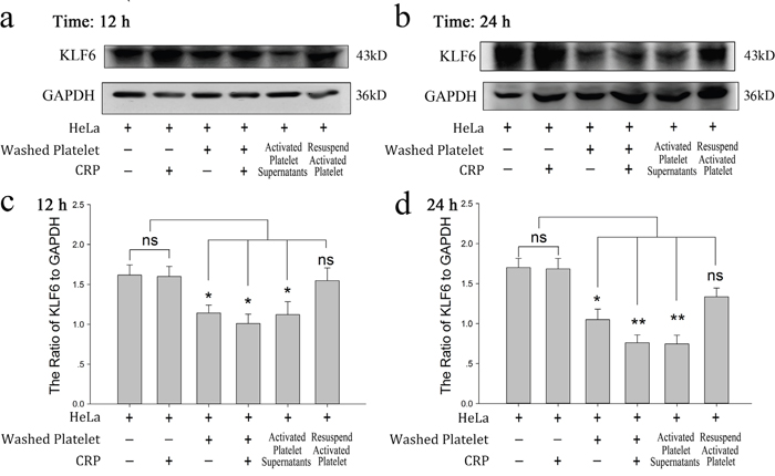 Effect of platelets on HeLa cells via reduced KLF6 expression.