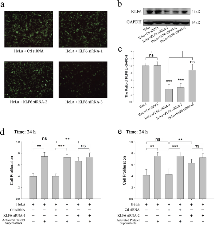 KLF6 gene silence dampened the proliferative effect of platelets on HeLa cells.