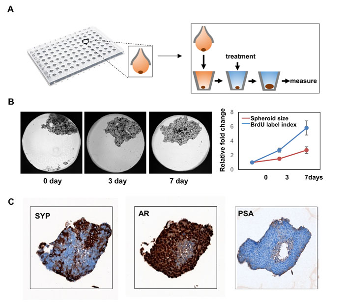 3-D culture of LnNE cells.