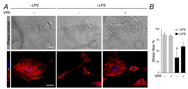 Valproate attenuates cellular shape changes, loss of stress fibers and disruption of actin cytoskeletal integrity in podocytes injured with LPS.