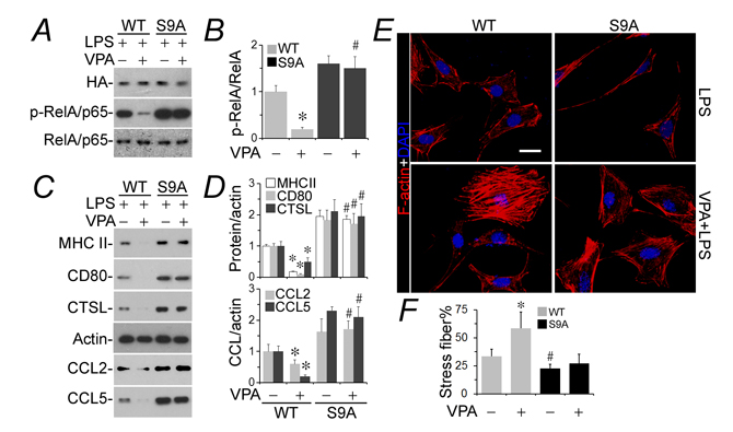 The podocyte protective activity of valproate is blunted in podocytes expressing a constitutively active mutant of GSK3&#x3b2;.