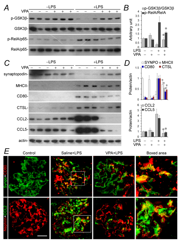 GSK3&#x3b2; overactivity and NFkB activation in glomeruli in LPS-injured mice were mitigated after valproate therapy, resulting in a blunted podocyte acquisition of immune phenotypes and podocytopathy.