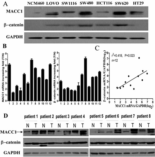 MACC1 protein expression in CRC cell lines (LOVO, SW1116, SW480, HCT116, SW620, and HT29) and normal colonic mucosa epithelial cell (NCM460) by western blot analysis (A); MACC1 and &#x3b2;-catenin mRNA expression in 12 pairs of fresh CRC and adjacent non-tumour colorectal mucosa (ANM) tissues by real-time PCR analysis (B); Significant positive correlation between MACC1 and &#x3b2;-catenin mRNA expression in such 12 pairs of fresh CRC and ANM tissues (C); MACC1 and &#x3b2;-catenin protein expression in 8 pairs of fresh CRC and ANM tissues by western blot analysis (D).