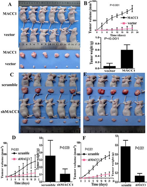 MACC1 over-expression significantly promoted tumor growth of HCT116 cells implanted subcutaneously in BALB/c-nu mice compared with the control group (p&lt;0.001; A, B-upper) and significantly increased tumor weight (P&lt;0.001; B-lower).