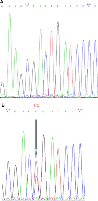 Representative results from Sanger sequencing for detection of the MYD88-L265P mutation.