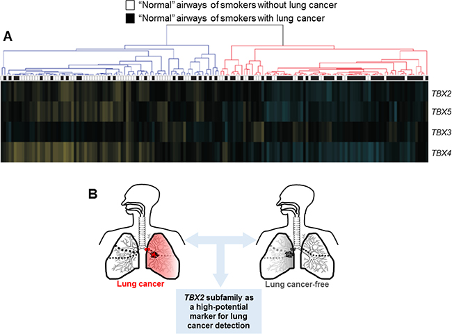 Suppression of the TBX2 subfamily in the airway field of injury in smokers.