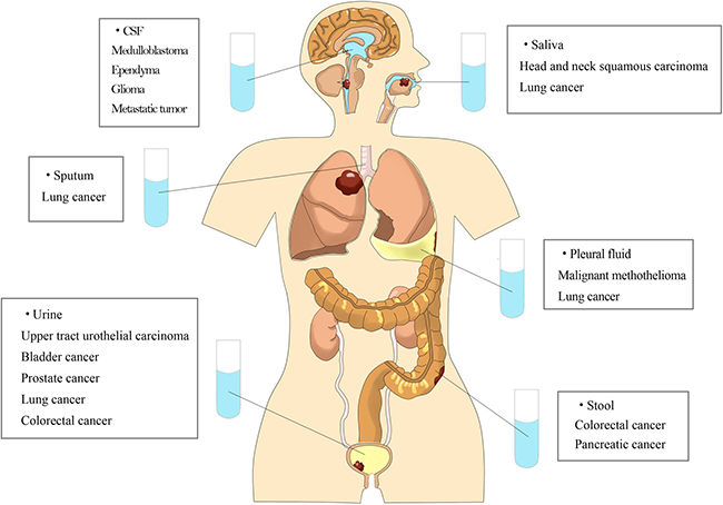 Tumor DNA can be detected in various kinds of non-blood body fluids.