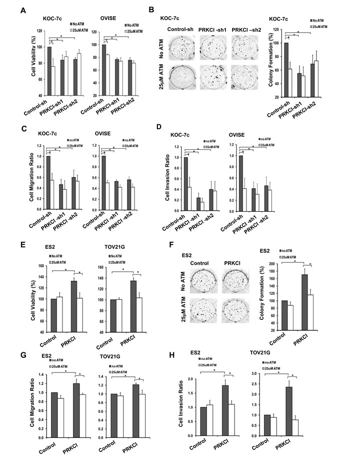 ATM suppression on oncogenic function of PRKCI