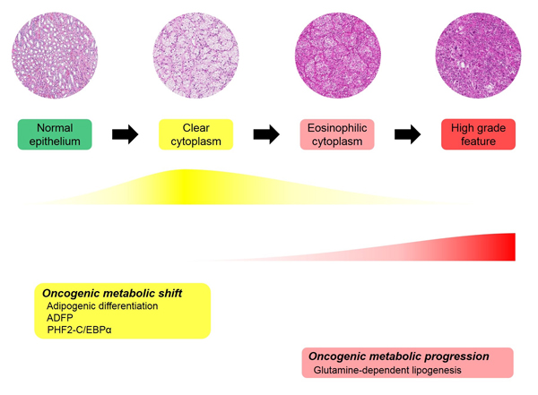 Proposed adipogenic metabolic evolution in ccRCC progression.