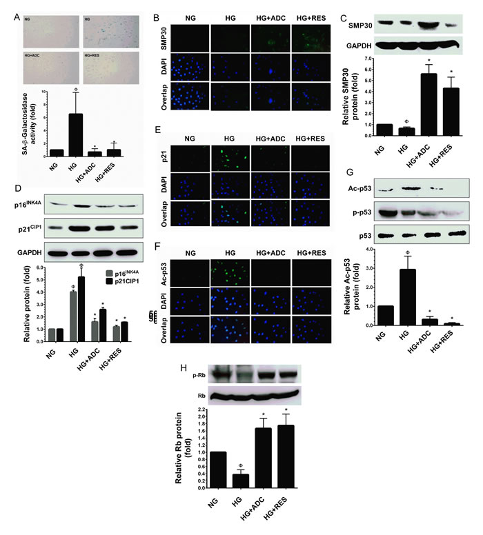 ADC prevents HG-induced senescence in HUVECs.
