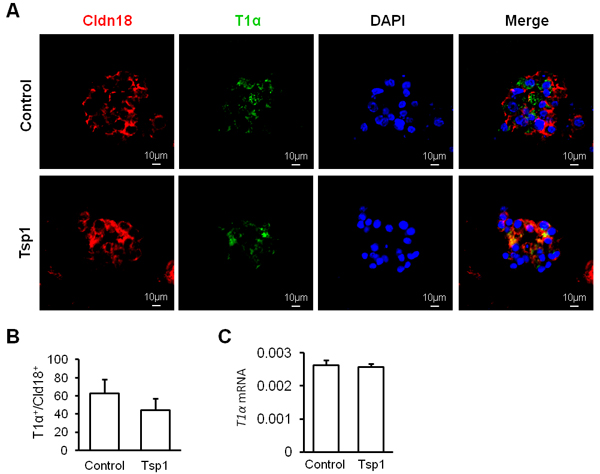 Tsp1 exhibits little effect on mouse AT2 cell differentiation.