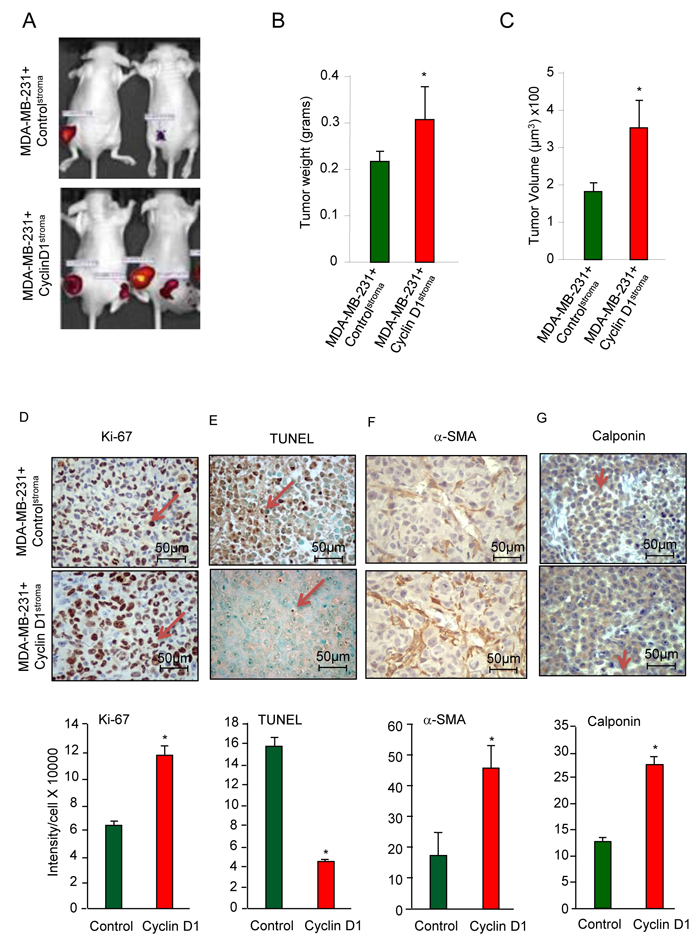 Stromal cyclin D1 expression increases breast tumor growth in mice.