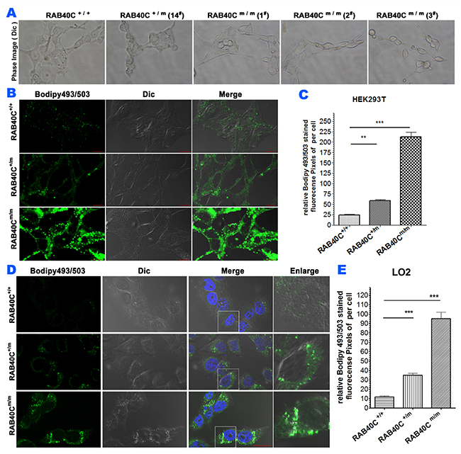 RAB40C deletion caused over-accumulation of lipid droplet.