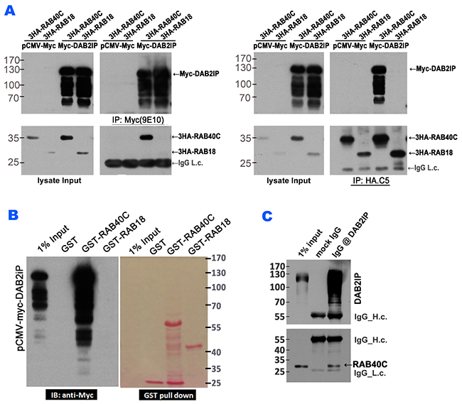 RAB40C interacted with DAB2IP.