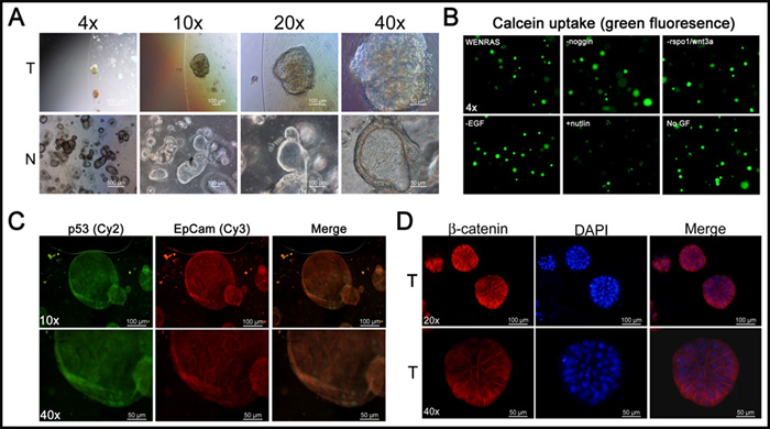 3D colon cancer organoid cultures with growth