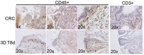 Immune profiling of patient donor tissues and the expression of immune cell markers from 3D ALI cultures