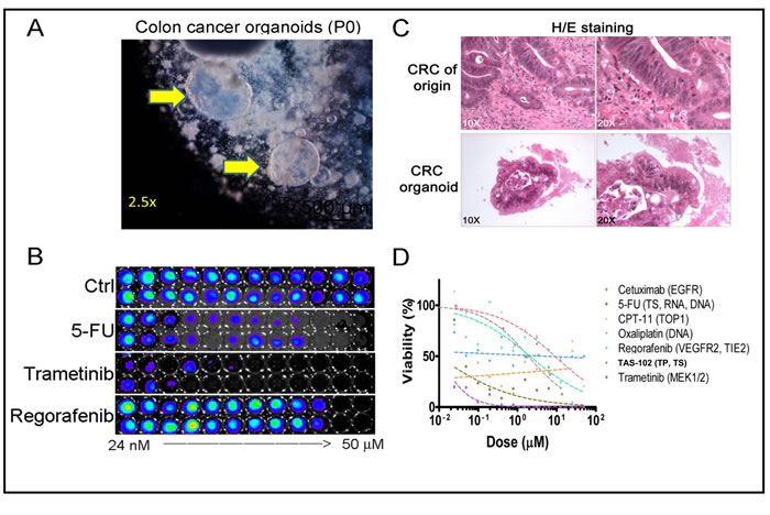 Assessment of CRC patient tumoroid responses to cytotoxic drugs