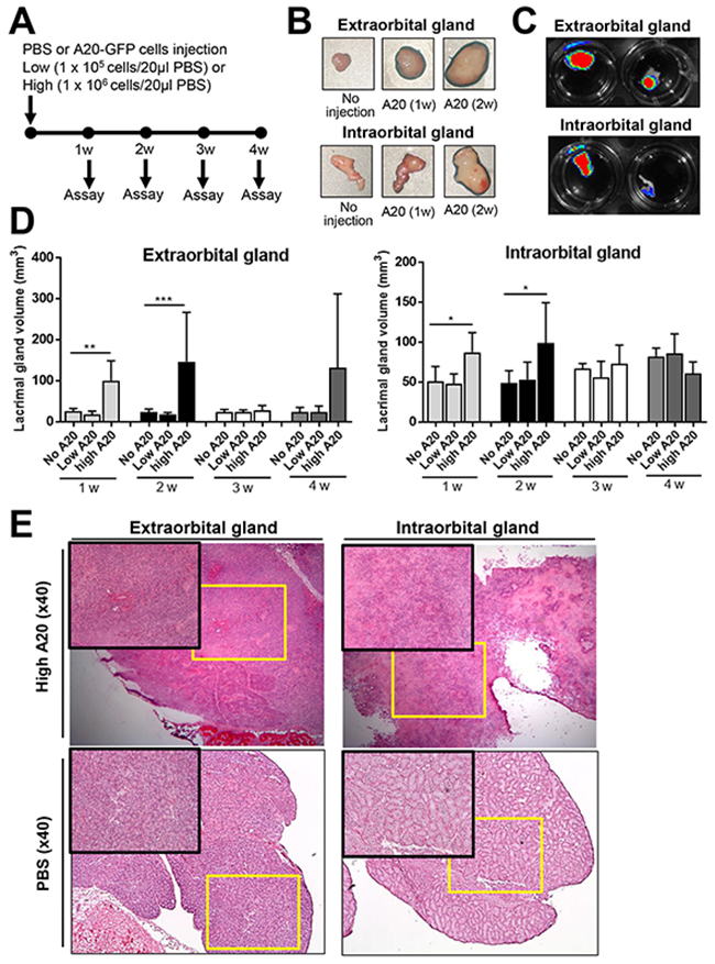 Establishment of B-cell lymphoma model in lacrimal glands.