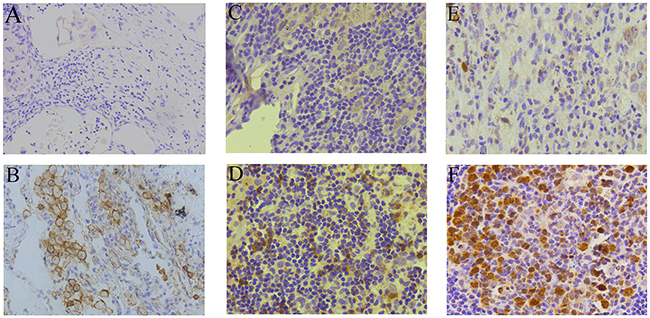 PD-L1, PD-1, and TS immunohistochemistry analysis.