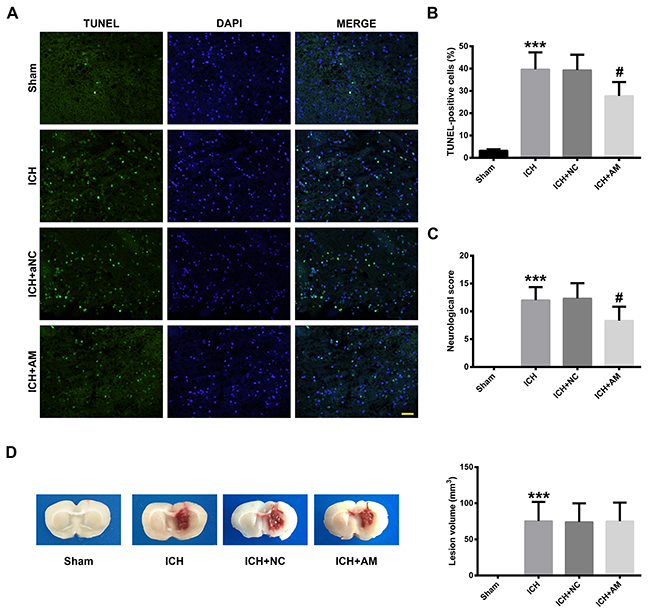 ICV injection of miR-27b AM alleviated cell death, neurological deficits but not lesion volume in ICH rats.