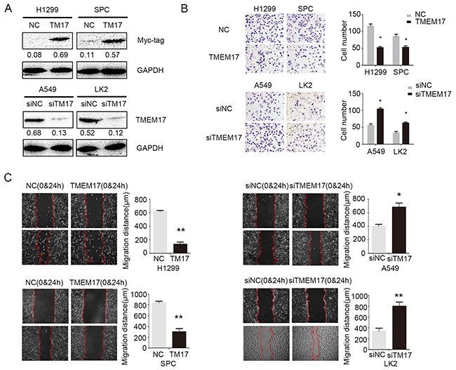 The effects on invasion and migration by overexpressing and depleting TMEM17.