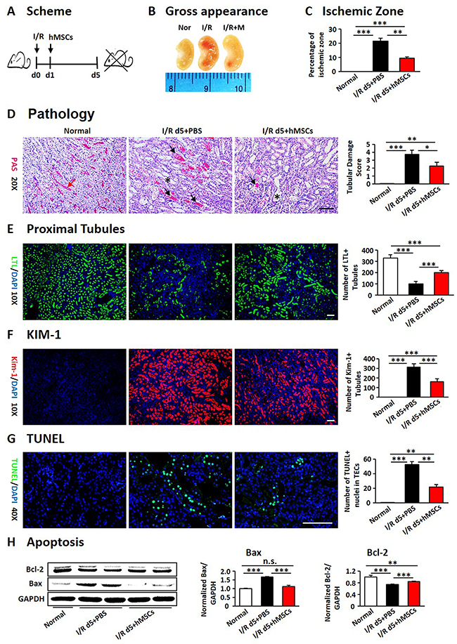 hAD-MSCs alleviated murine AKI in I/R.