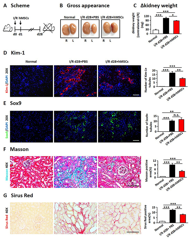 hAD-MSCs mitigated chronic kidney injury in I/R.