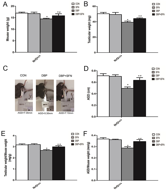 Effect of DBP stimulation and SFN supplementation on AGD and testes growth in Nrf2+/+ mice.